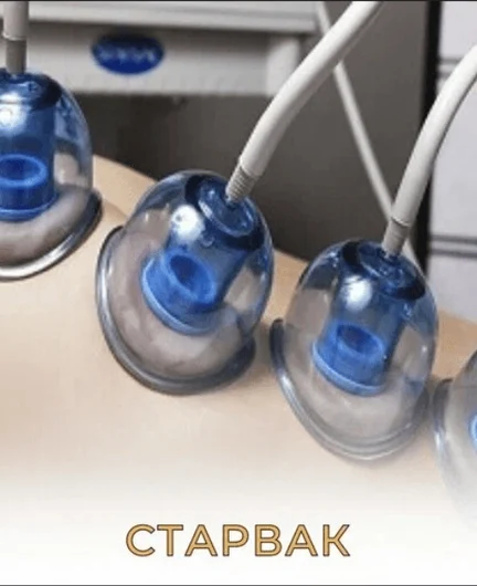 ed09b79d-4c80-4c4d-83f3-396182811ece-старвак.png